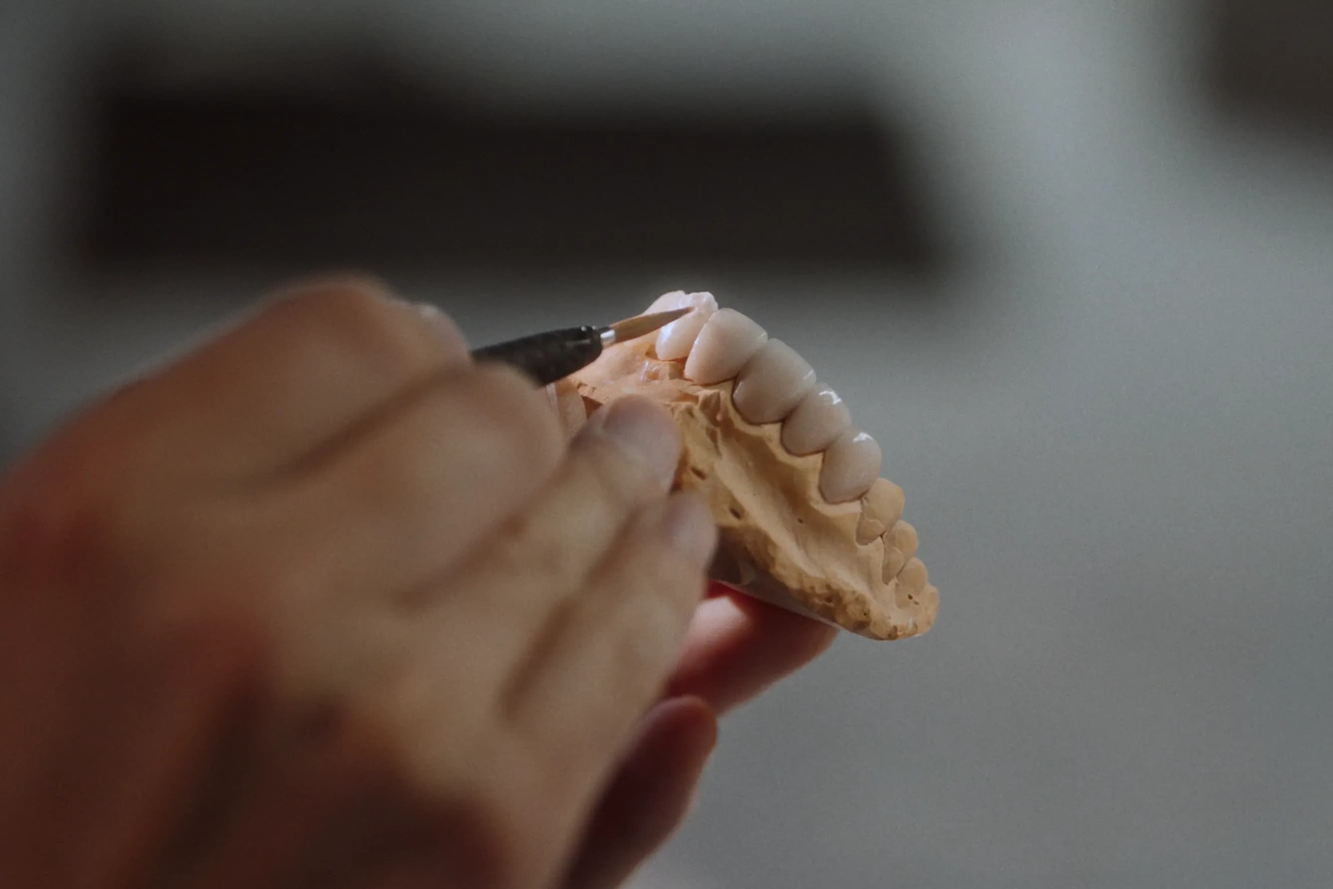 Premium One Day Veneers in Gangnam - Digital Precision 3D scanning technology