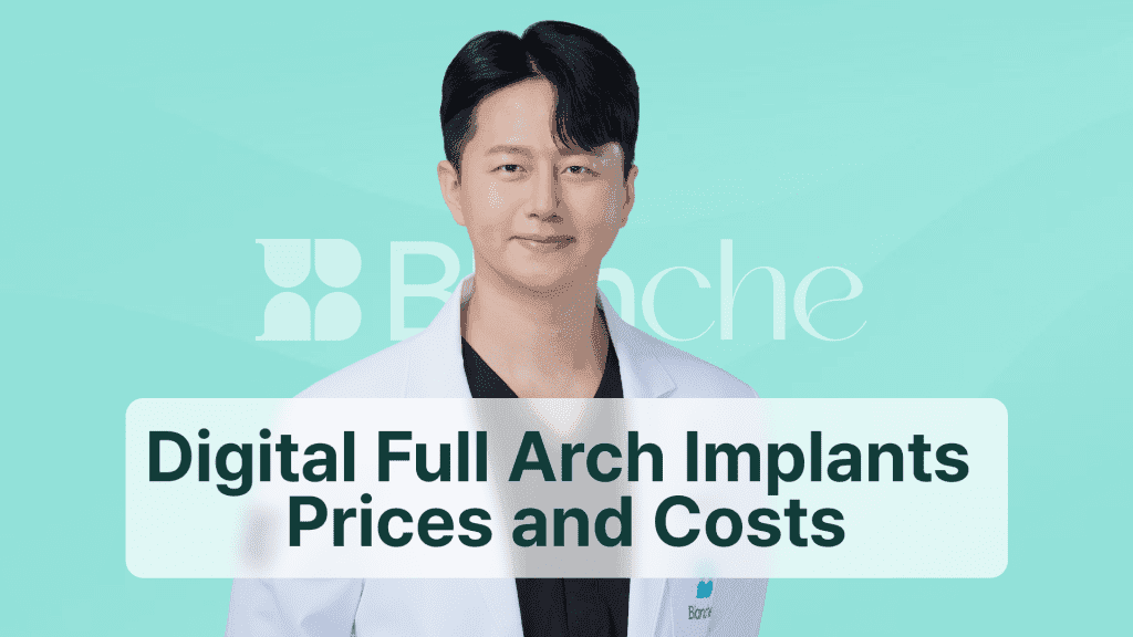 Digital Full Arch Implants Prices and Costs