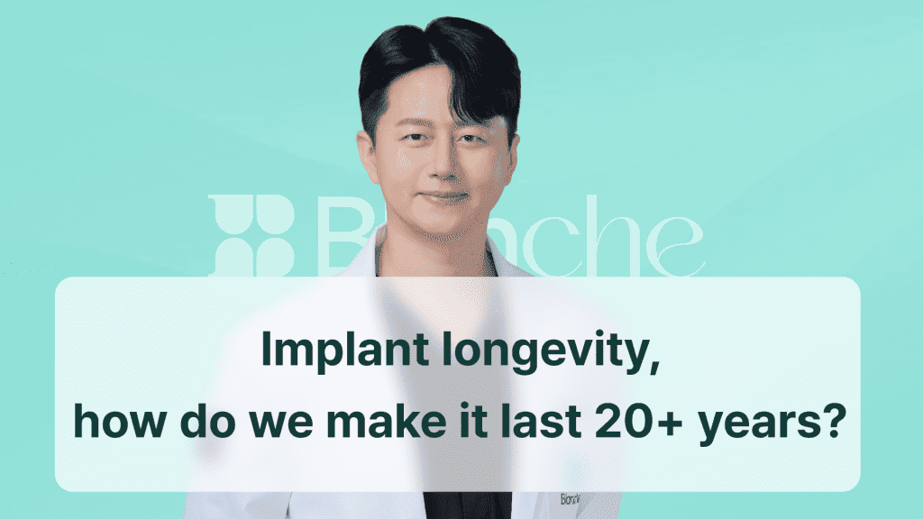 Implant longevity, how do we make it last 20+ years?