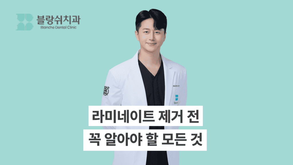 라미네이트 제거 전 꼭 알아야 할 모든 것