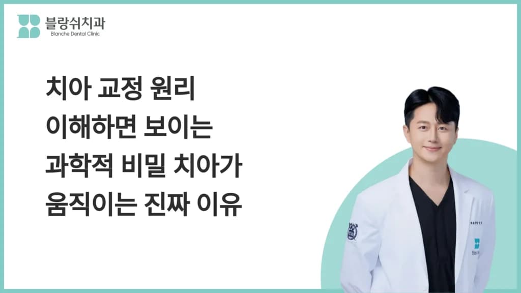 치아 교정 원리 이해하면 보이는 과학적 비밀 치아가 움직이는 진짜 이유 대표 이미지