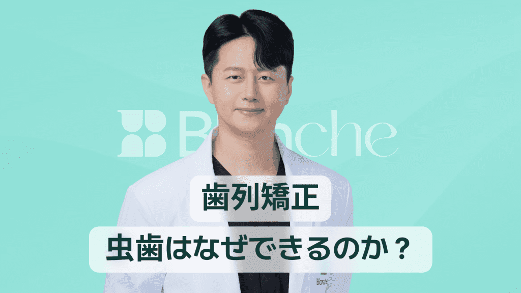 【韓国歯科】歯列矯正中の虫歯：なぜできる？どう予防する？矯正段階別完全管理ガイド