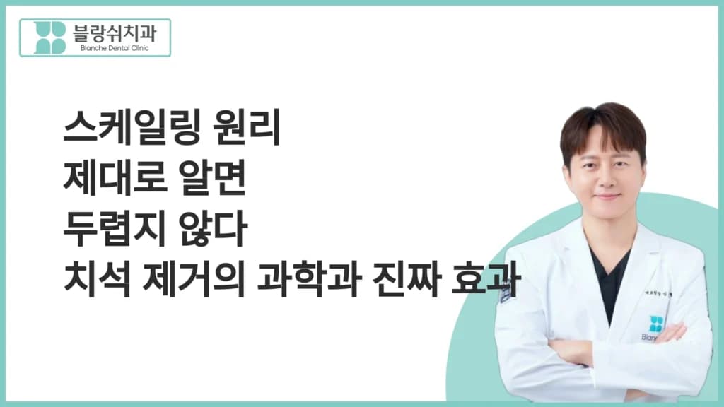 스케일링 원리 제대로 알면 두렵지 않다 치석 제거의 과학과 진짜 효과 대표 이미지