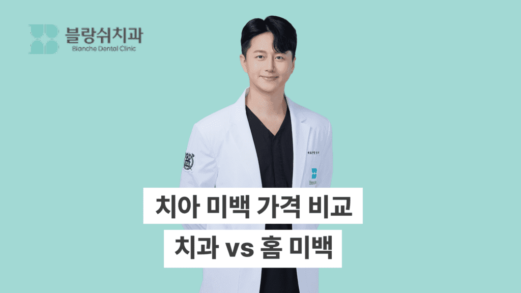 치아 미백 가격 비교