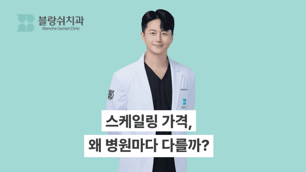 스케일링 가격