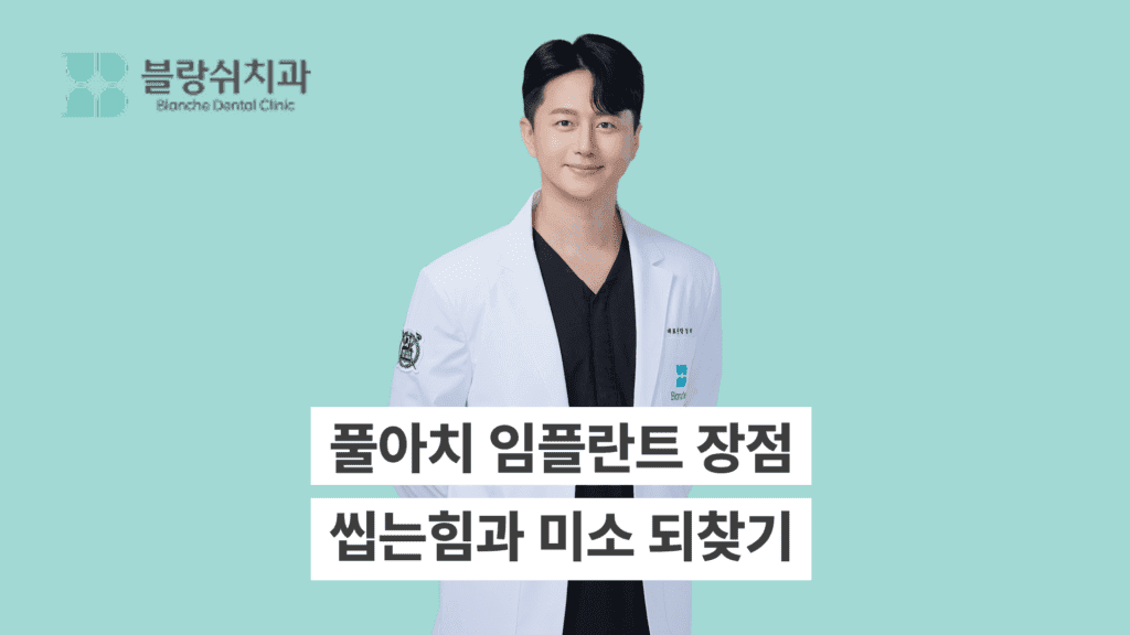 풀아치 임플란트의 장점, 씹는 힘과 미소를 되찾으세요 대표 이미지