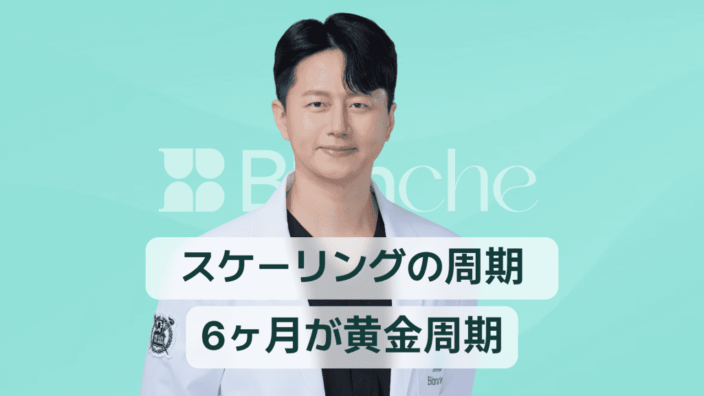 【韓国歯科】歯石除去（スケーリング）の周期、なぜ6ヶ月が黄金基準なのか？歯科専門医が解説します。