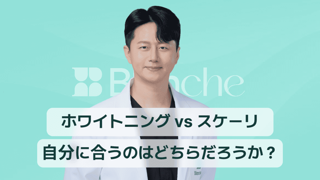 【韓国歯科】歯のホワイトニング vs スケーリング、自分に合うのはどっち？