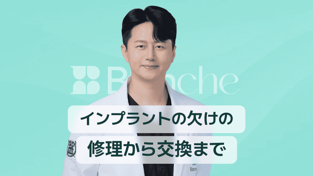 【韓国歯科】インプラントの破損費用、修理から再施術まで一度にチェック