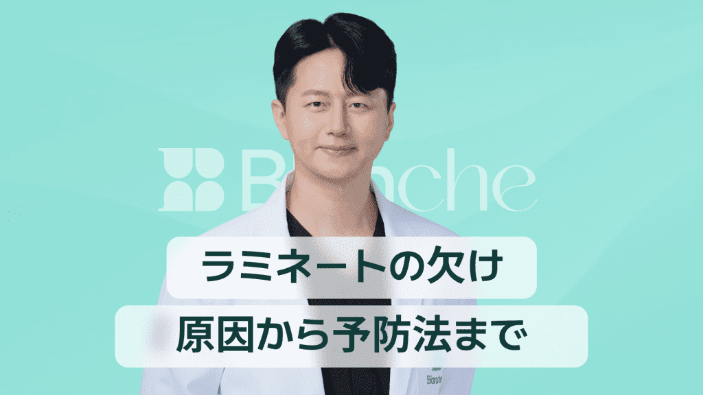 【韓国歯科】ラミネートが割れる理由とは？原因から修理費用、予防法まで