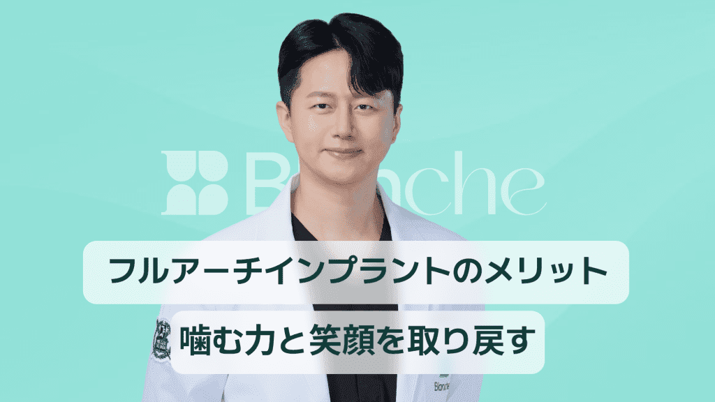 【韓国歯科】フルアーチインプラントのメリット、咀嚼力と笑顔を取り戻してください。