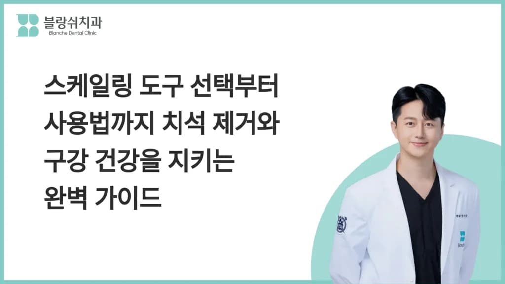 스케일링 도구 선택부터 사용법까지 치석 제거와 구강 건강을 지키는 완벽 가이드 대표 이미지