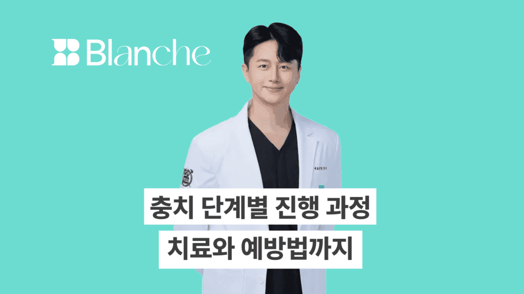 충치 단계별 진행과정