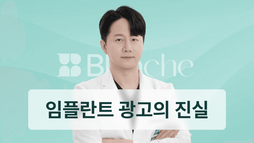 임플란트 30만원 광고의 진실! 숨은 비용부터 합리적인 병원 선택까지