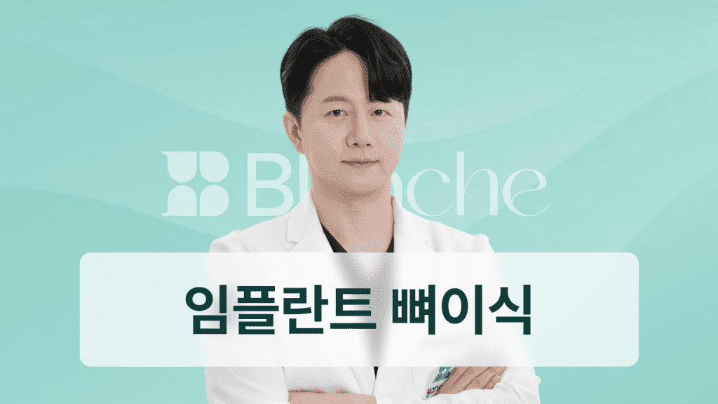 임플란트 뼈이식, 어떤 경우에 해야할까요? 정의, 재료, 추천대상 등