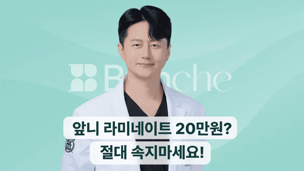 앞니라미네이트가격, 개당 20만원? 속지 마세요! 적정 비용, 부작용, 후기까지