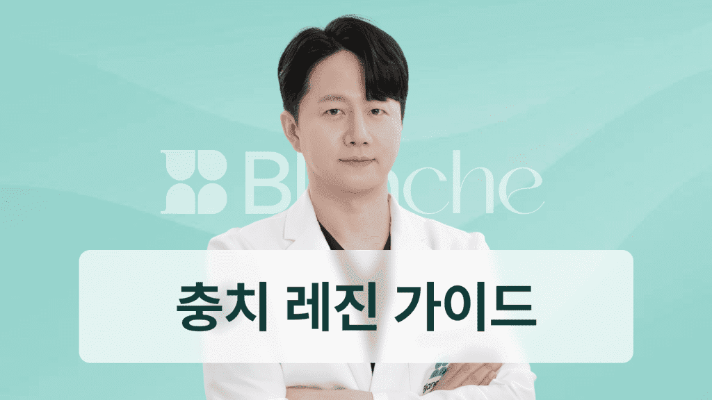 충치 레진 치료 완벽가이드 초기충치부터 비용까지 한눈에 끝내는 치과정보