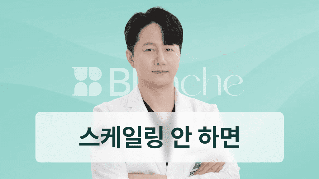 스케일링 안하는 사람에게 나타나는 충격적 변화 평생 방치하면 치아에 생기는 일