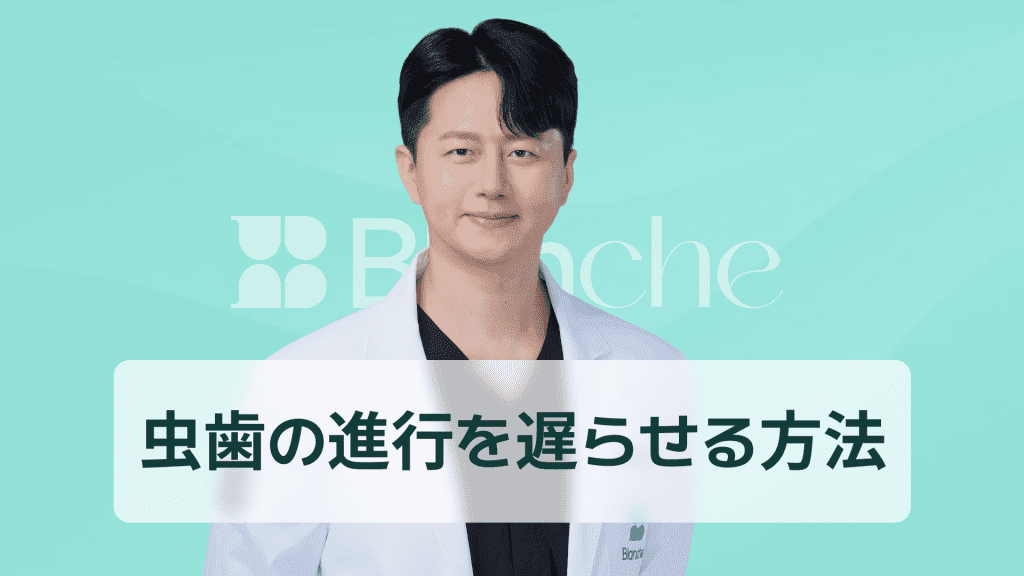 【韓国歯科】虫歯の進行速度の段階別変化と遅らせる方法、歯科医師が教える現実的な管理法