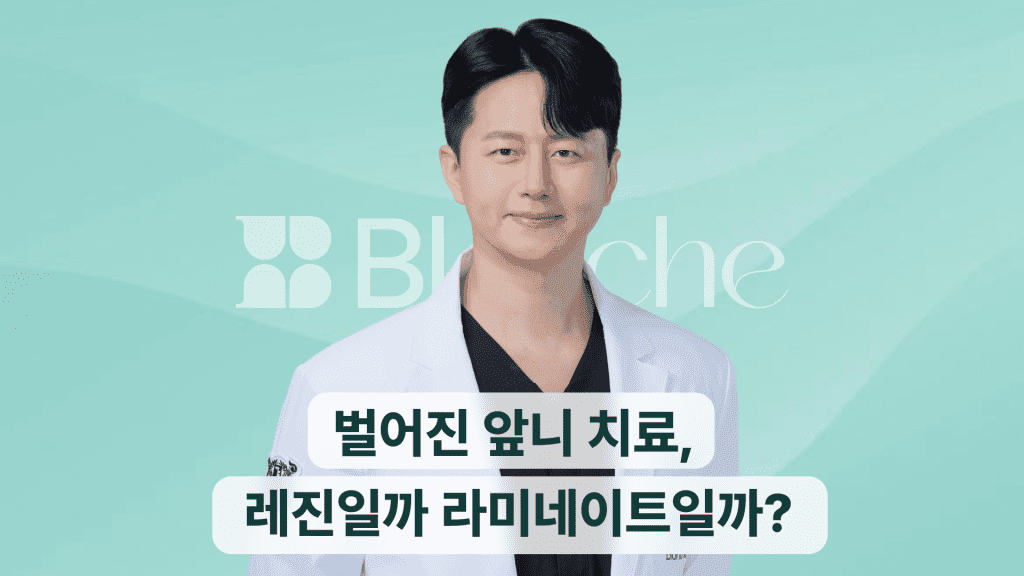 벌어진 앞니 치료, 레진일까 라미네이트일까?