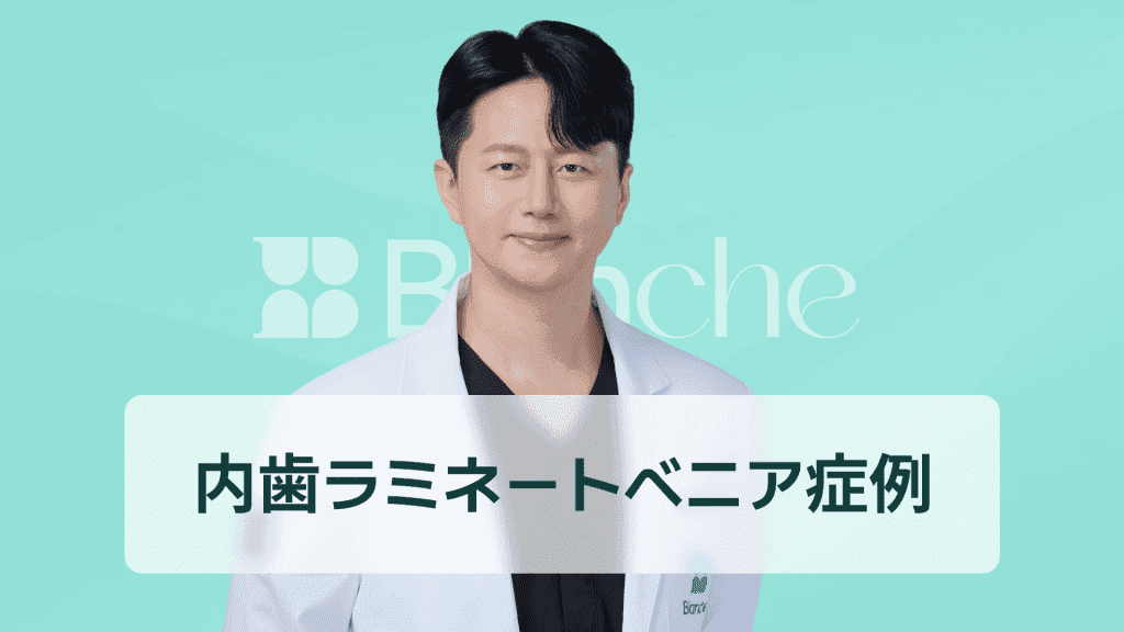 【韓国歯科】出っ歯とは何でしょうか？出っ歯ラミネート事例