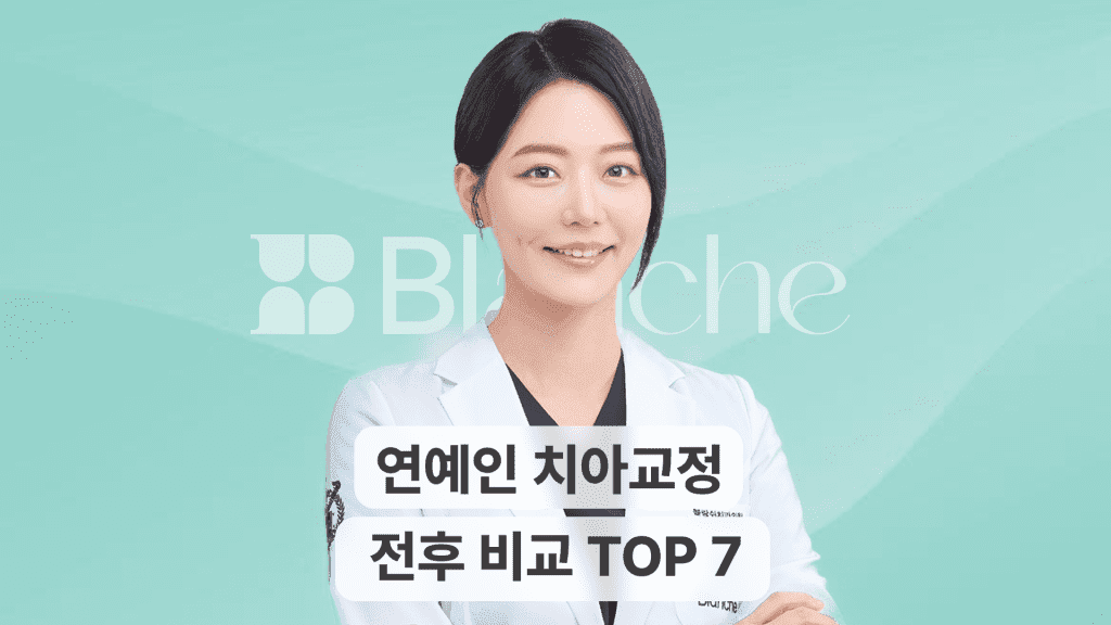 남주혁부터 장원영, 김연아까지 연예인 치아교정 전후 비교 TOP 7 대표 이미지