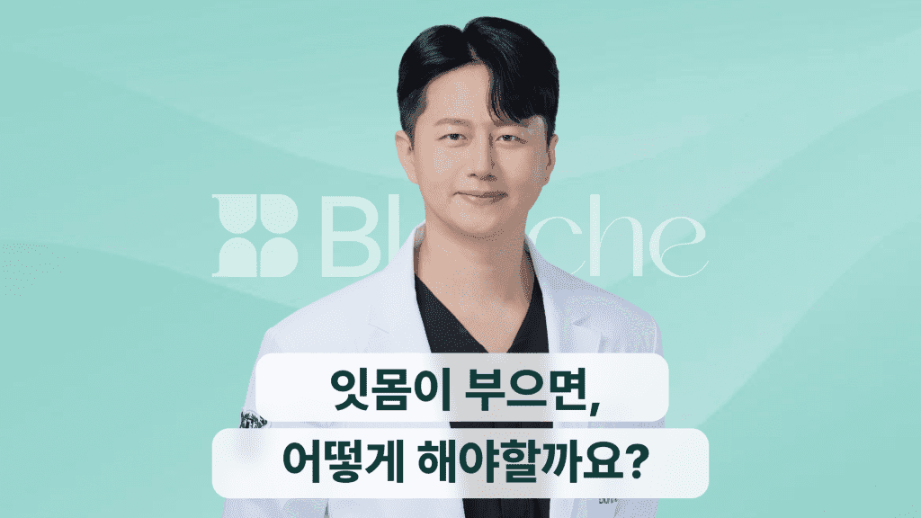 잇몸이 부으면 어떻게 해야할까요?