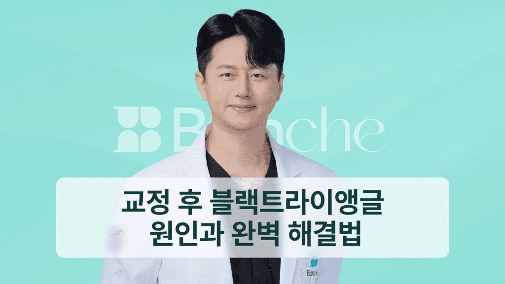 교정 후 블랙트라이앵글 원인과 완벽 해결법