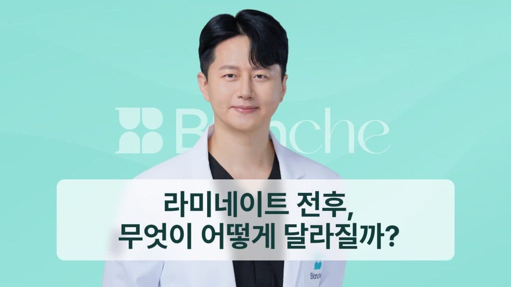 라미네이트 전후, 무엇이 어떻게 달라질까?