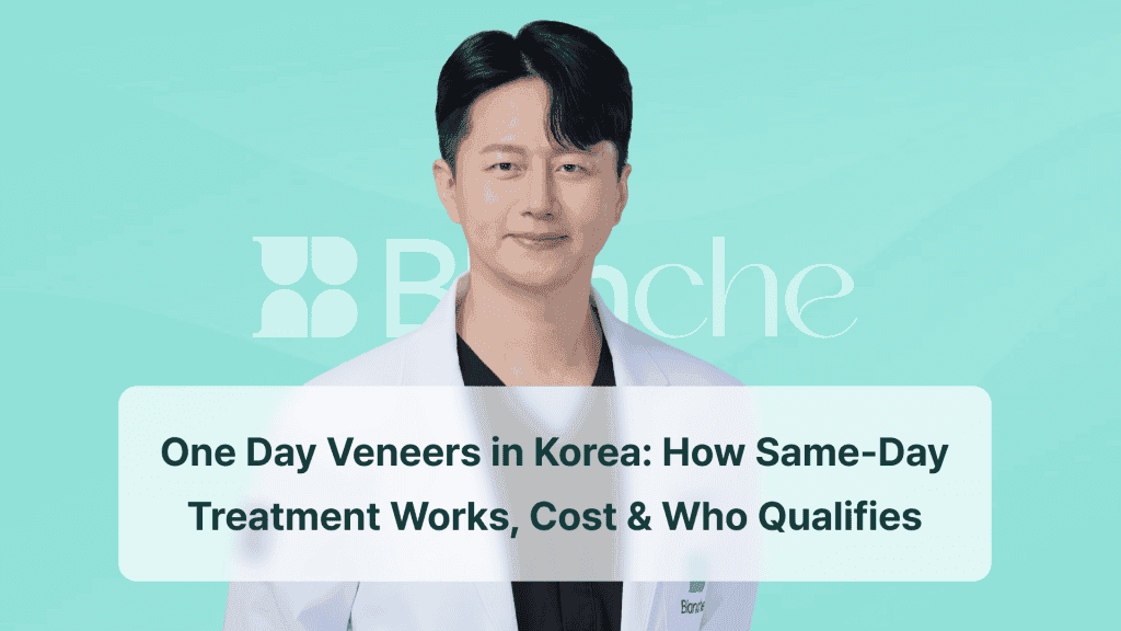Same-Day Veneers