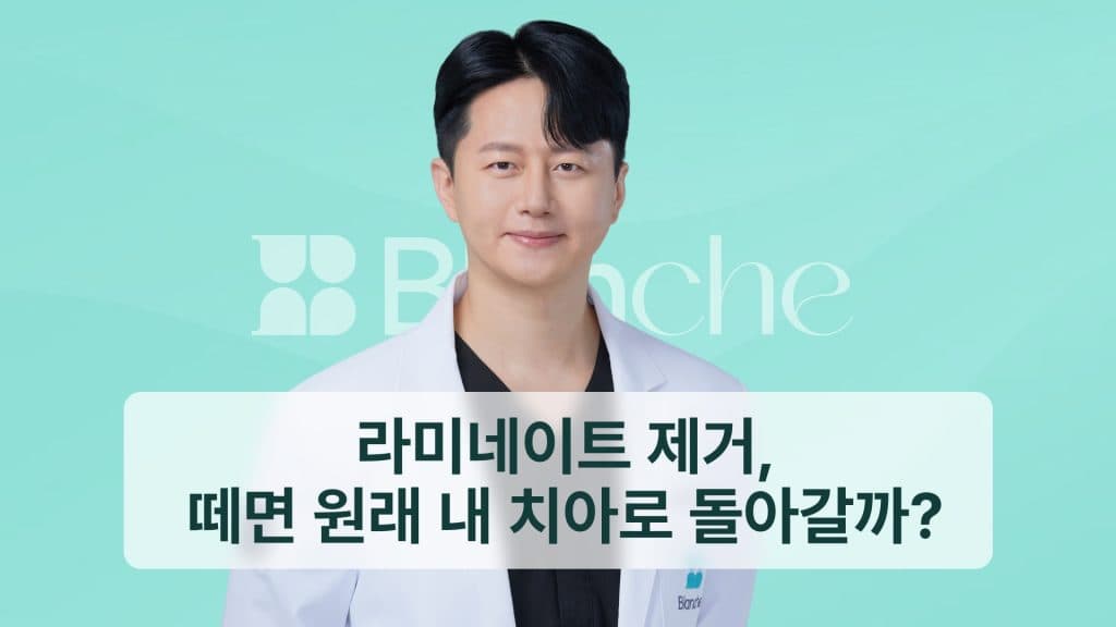 라미네이트 제거, 떼면 원래 내 치아로 돌아갈까?