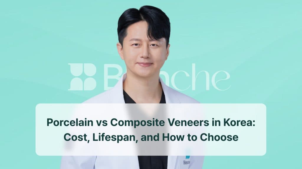 Porcelain vs Composite Veneers in Korea: Cost, Lifespan, and How to Choose