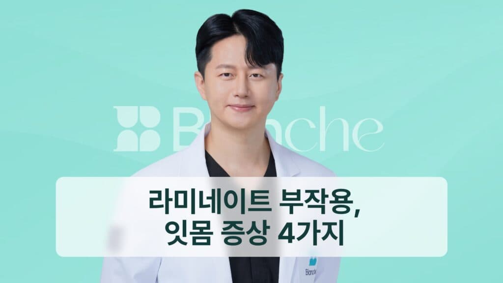 라미네이트 부작용, 잇몸증상 4가지