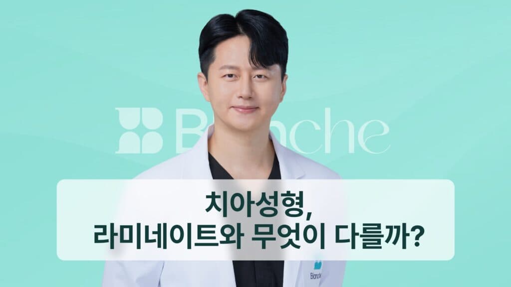 치아성형, 라미네이트와 무엇이 다를까?