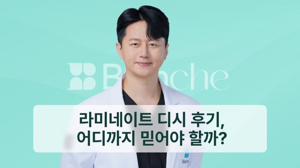 라미네이트 디시 후기