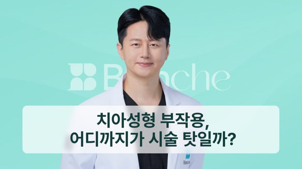치아성형 부작용, 어디까지가 시술 탓일까?