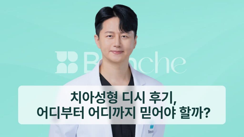 치아성형 디시 후기, 어디부터 어디까지 믿어야 할까?