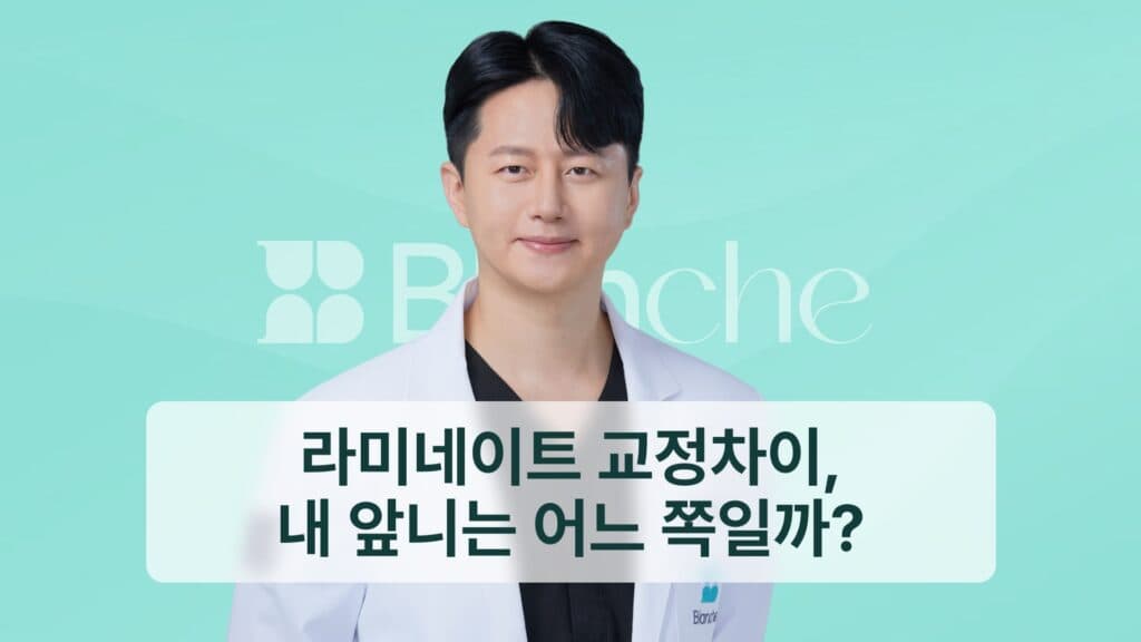 라미네이트 교정 차이, 내 앞니는 어느 쪽일까?