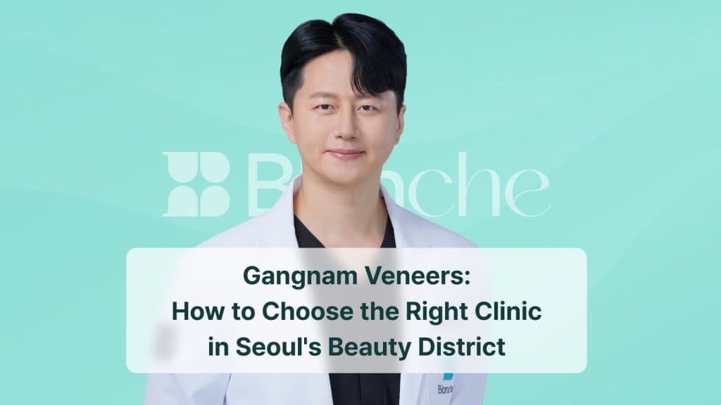 Gangnam Veneers: How to Choose the Right Clinic in Seoul's Beauty District