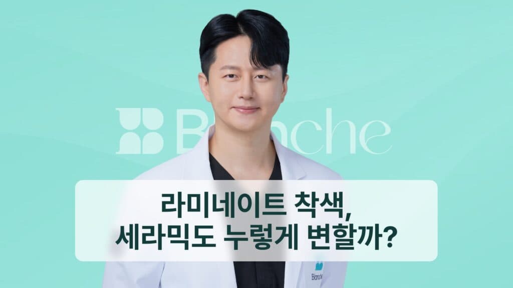 라미네이트 착색, 세라믹도 누렇게 변할까?