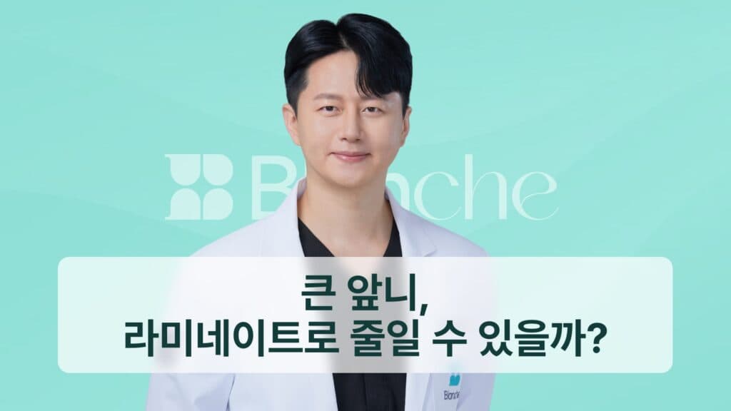 썸네일 - 큰 앞니, 라미네이트로 줄일 수 있을까?