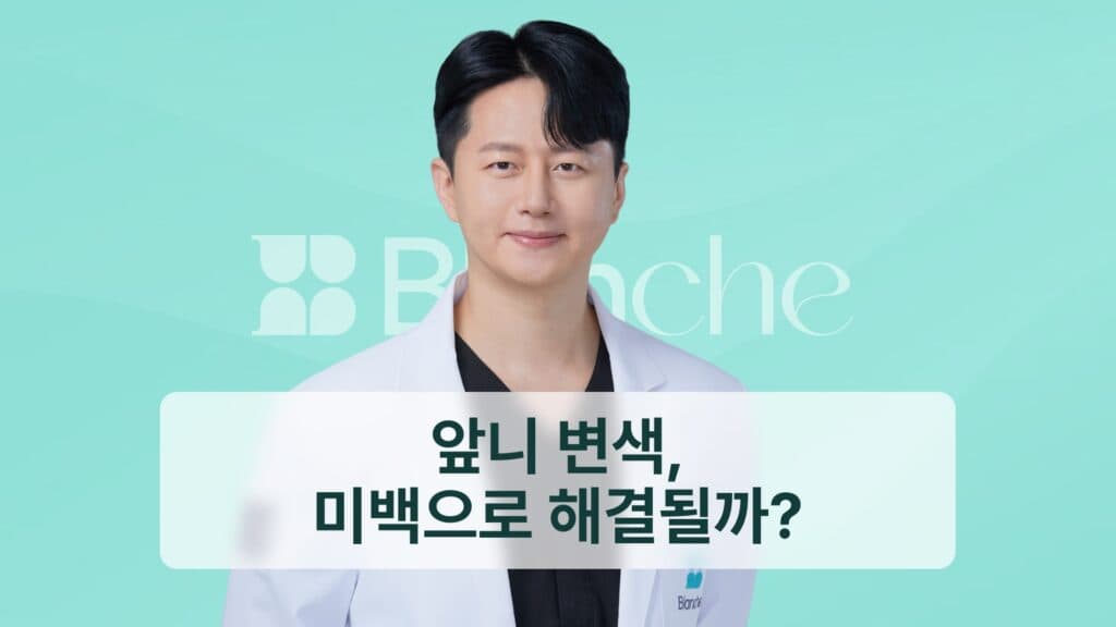썸네일 - 앞니 변색, 미백으로 해결될까?