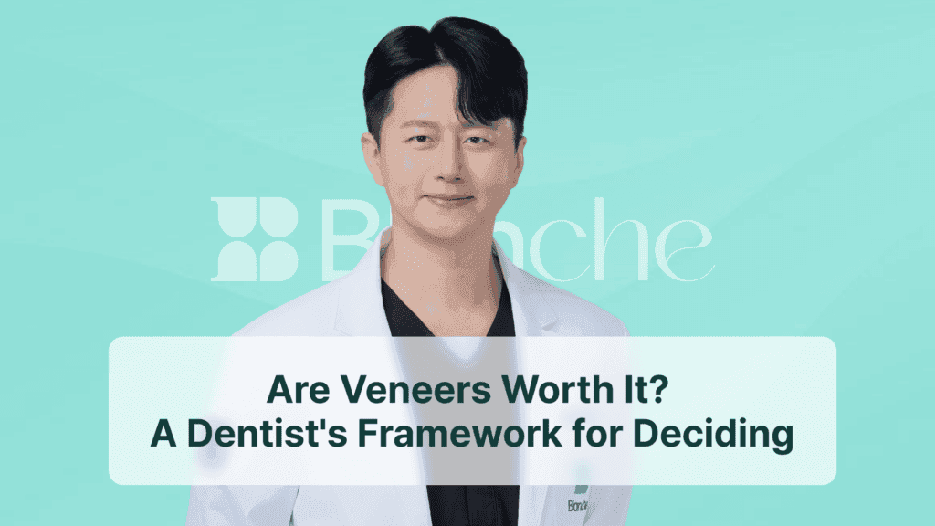 Are Veneers Worth It? A Dentist's Framework for Deciding