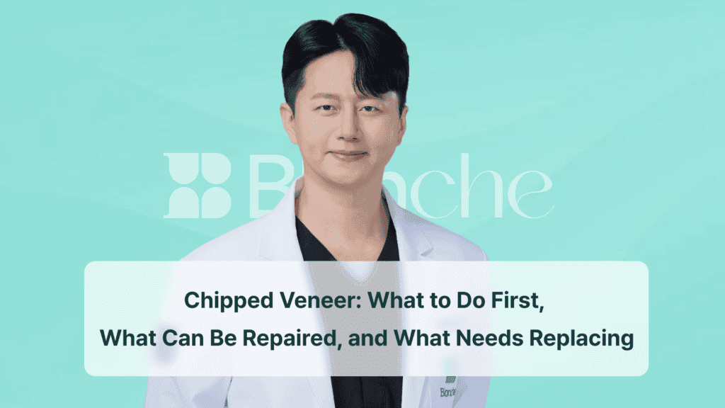 Chipped Veneer: What to Do First, What Can Be Repaired, and What Needs Replacing