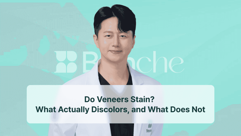 Do Veneers Stain? What Actually Discolors, and What Does Not