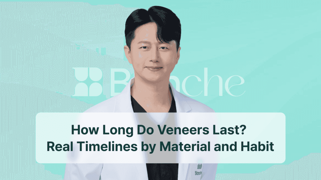 How Long Do Veneers Last? Real Timelines by Material and Habit