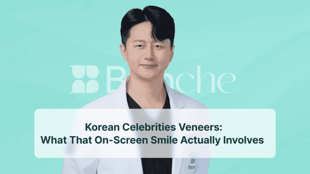 Korean Celebrities Veneers: What That On-Screen Smile Actually Involves
