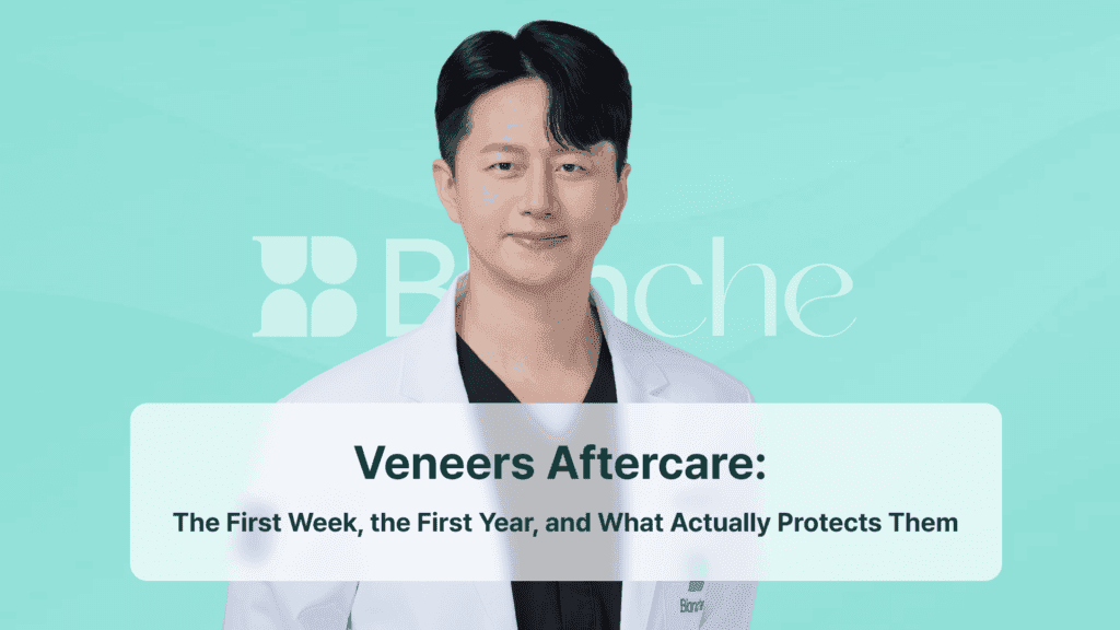 Veneers Aftercare: The First Week, the First Year, and What Actually Protects Them