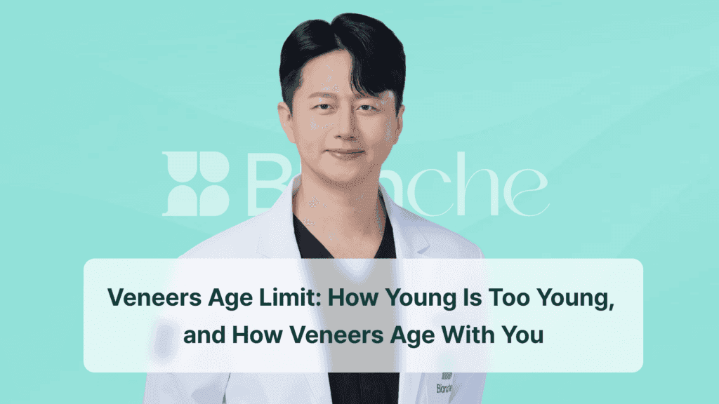 Veneers Age Limit: How Young Is Too Young, and How Veneers Age With You