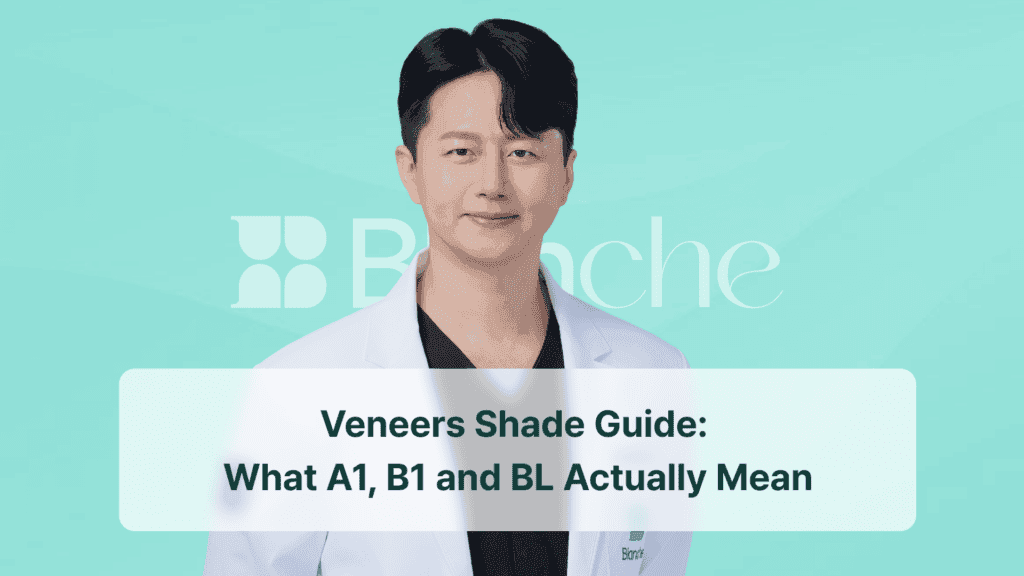 Veneers Shade Guide: What A1, B1 and BL Actually Mean